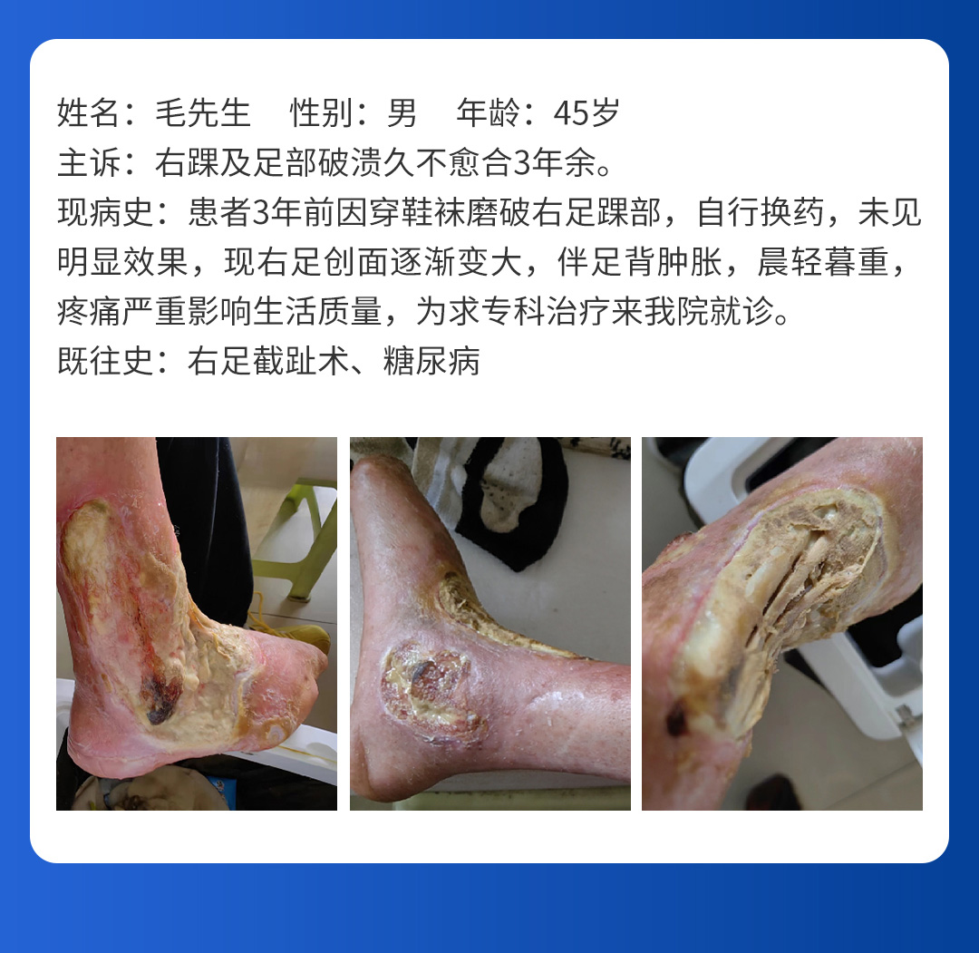 【北京市中西医结合大发平台官方版下载】首期会诊圆满成功！(图8)