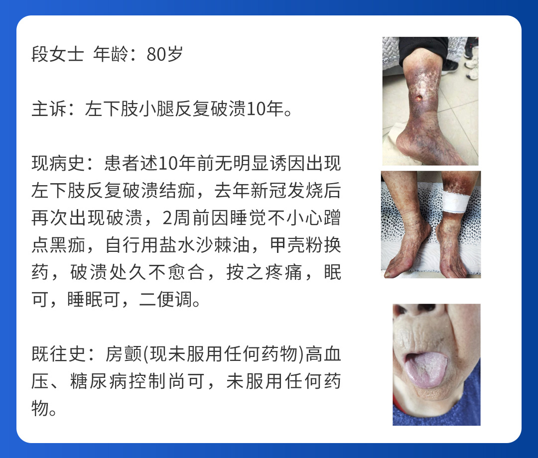 【北京市中西医结合大发平台官方版下载】第三期会诊(图6)